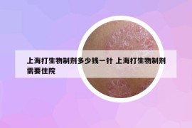 上海打生物制劑多少錢一針 上海打生物制劑需要住院