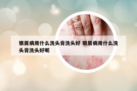 銀屑病用什么洗頭膏洗頭好 銀屑病用什么洗頭膏洗頭好呢