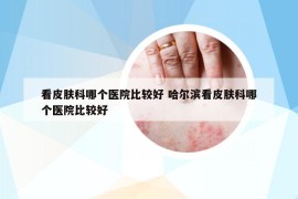 看皮膚科哪個醫(yī)院比較好 哈爾濱看皮膚科哪個醫(yī)院比較好