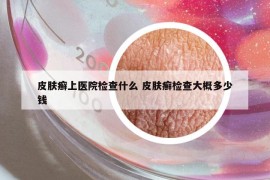 皮膚癬上醫(yī)院檢查什么 皮膚癬檢查大概多少錢
