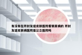 有沒有在開封友誼皮膚醫(yī)院看銀屑病的 開封友誼皮膚病醫(yī)院是公立醫(yī)院嗎