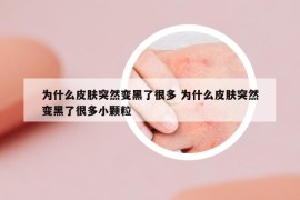 為什么皮膚突然變黑了很多 為什么皮膚突然變黑了很多小顆粒