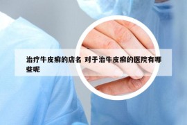 治療牛皮癬的店名 對(duì)于治牛皮癬的醫(yī)院有哪些呢