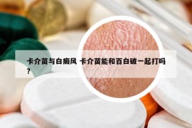 卡介苗與白癜風(fēng) 卡介苗能和百白破一起打嗎?