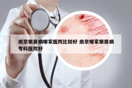 南京銀屑病哪家醫(yī)院比較好 南京哪家銀屑病專科醫(yī)院好