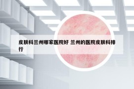 皮膚科蘭州哪家醫(yī)院好 蘭州的醫(yī)院皮膚科排行