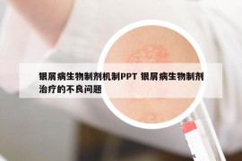 銀屑病生物制劑機制PPT 銀屑病生物制劑治療的不良問題