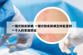 一鍵識別皮膚病 一鍵識別皮膚病怎樣能查到一個人的家庭地址