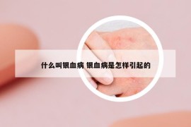 什么叫銀血病 銀血病是怎樣引起的