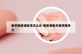 春季銀屑病復(fù)發(fā)怎么辦 銀屑病春天爆發(fā)期多久