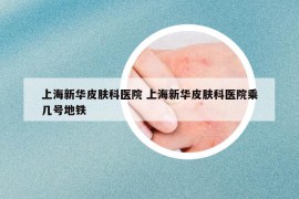 上海新華皮膚科醫(yī)院 上海新華皮膚科醫(yī)院乘幾號(hào)地鐵
