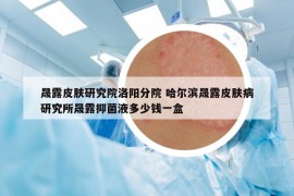 晟露皮膚研究院洛陽分院 哈爾濱晟露皮膚病研究所晟露抑菌液多少錢一盒