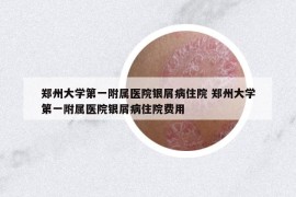 鄭州大學第一附屬醫(yī)院銀屑病住院 鄭州大學第一附屬醫(yī)院銀屑病住院費用