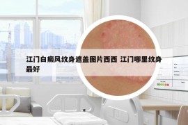 江門白癜風紋身遮蓋圖片西西 江門哪里紋身最好