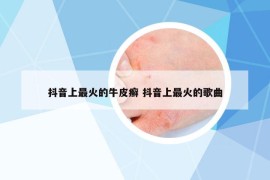 抖音上最火的牛皮癬 抖音上最火的歌曲