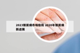 2023銀屑病市場格局 2020年銀屑病新進展
