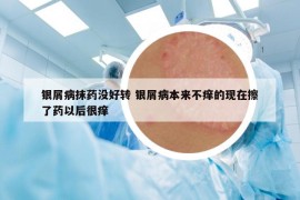 銀屑病抹藥沒好轉(zhuǎn) 銀屑病本來(lái)不癢的現(xiàn)在擦了藥以后很癢