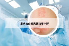 重慶治白癜風(fēng)醫(yī)院哪個(gè)好