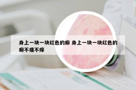 身上一塊一塊紅色的癬 身上一塊一塊紅色的癬不痛不癢