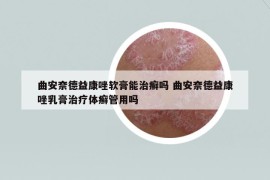 曲安奈德益康唑軟膏能治癬嗎 曲安奈德益康唑乳膏治療體癬管用嗎