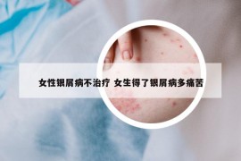 女性銀屑病不治療 女生得了銀屑病多痛苦