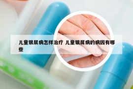 兒童銀屑病怎樣治療 兒童銀屑病的病因有哪些