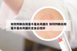 如何判斷白斑是不是白風(fēng)圖片 如何判斷白斑是不是白風(fēng)圖片定金云桂好