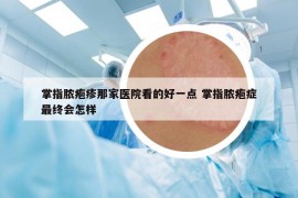 掌指膿皰疹那家醫(yī)院看的好一點 掌指膿皰癥最終會怎樣