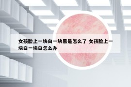 女孩臉上一塊白一塊黑是怎么了 女孩臉上一塊白一塊白怎么辦
