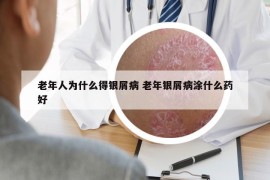 老年人為什么得銀屑病 老年銀屑病涂什么藥好
