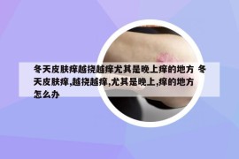 冬天皮膚癢越撓越癢尤其是晚上癢的地方 冬天皮膚癢,越撓越癢,尤其是晚上,癢的地方怎么辦