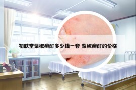 初膚堂紫椒癬酊多少錢一套 紫椒癬酊的價格