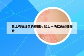 臉上有塊紅色的癬圖片 臉上一塊紅色的蘚圖片