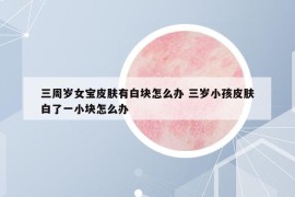 三周歲女寶皮膚有白塊怎么辦 三歲小孩皮膚白了一小塊怎么辦