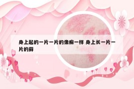 身上起的一片一片的像癬一樣 身上長(zhǎng)一片一片的蘚
