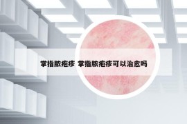 掌指膿皰疹 掌指膿皰疹可以治愈嗎