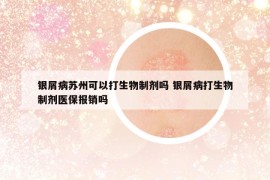 銀屑病蘇州可以打生物制劑嗎 銀屑病打生物制劑醫(yī)保報銷嗎