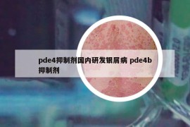 pde4抑制劑國內(nèi)研發(fā)銀屑病 pde4b抑制劑