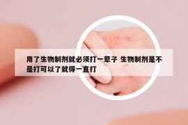 用了生物制劑就必須打一輩子 生物制劑是不是打可以了就得一直打