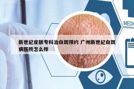新世紀(jì)皮膚?？浦伟装哳A(yù)約 廣州新世紀(jì)白斑病醫(yī)院怎么樣