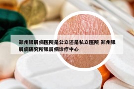 鄭州銀屑病醫(yī)院是公立還是私立醫(yī)院 鄭州銀屑病研究所銀屑病診療中心