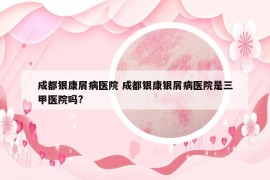 成都銀康屑病醫(yī)院 成都銀康銀屑病醫(yī)院是三甲醫(yī)院嗎?