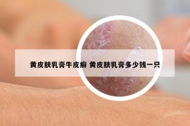 黃皮膚乳膏牛皮癬 黃皮膚乳膏多少錢一只