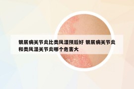 銀屑病關(guān)節(jié)炎比類風(fēng)濕預(yù)后好 銀屑病關(guān)節(jié)炎和類風(fēng)濕關(guān)節(jié)炎哪個(gè)危害大