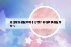 廊坊銀屑病醫(yī)院哪個(gè)比較好 廊坊皮膚病醫(yī)院排行