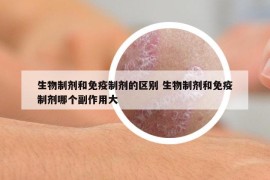 生物制劑和免疫制劑的區(qū)別 生物制劑和免疫制劑哪個(gè)副作用大