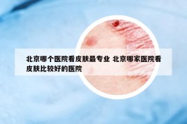 北京哪個醫(yī)院看皮膚最專業(yè) 北京哪家醫(yī)院看皮膚比較好的醫(yī)院