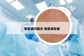 銀屑病閃罐法 銀屑病走罐