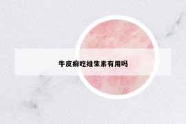 牛皮癬吃維生素有用嗎