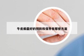 牛皮癬最好的預(yù)防和保養(yǎng)有那些方面